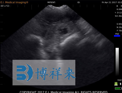 母豬18天懷孕B超圖像