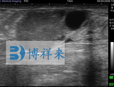 牛懷孕25天影像圖