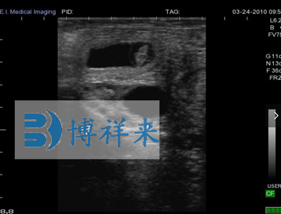 牛懷孕34天影像圖