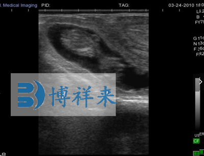 牛懷孕49天影像圖