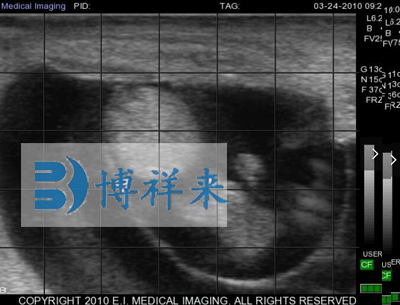 牛懷孕54天影像圖