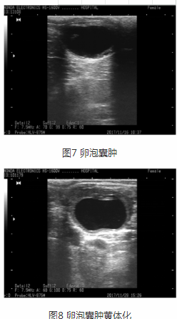 奶牛卵巢囊腫圖1