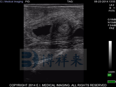 牛用B超機28天影像