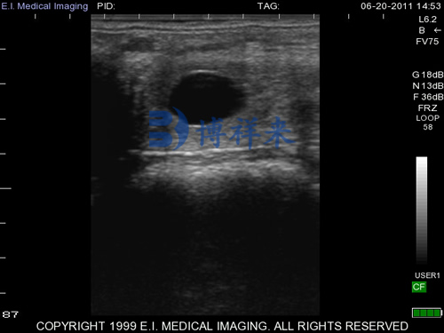 獸用B超檢測母馬妊娠超聲圖像