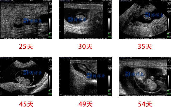 牛用B超胎齡檢測超聲圖像