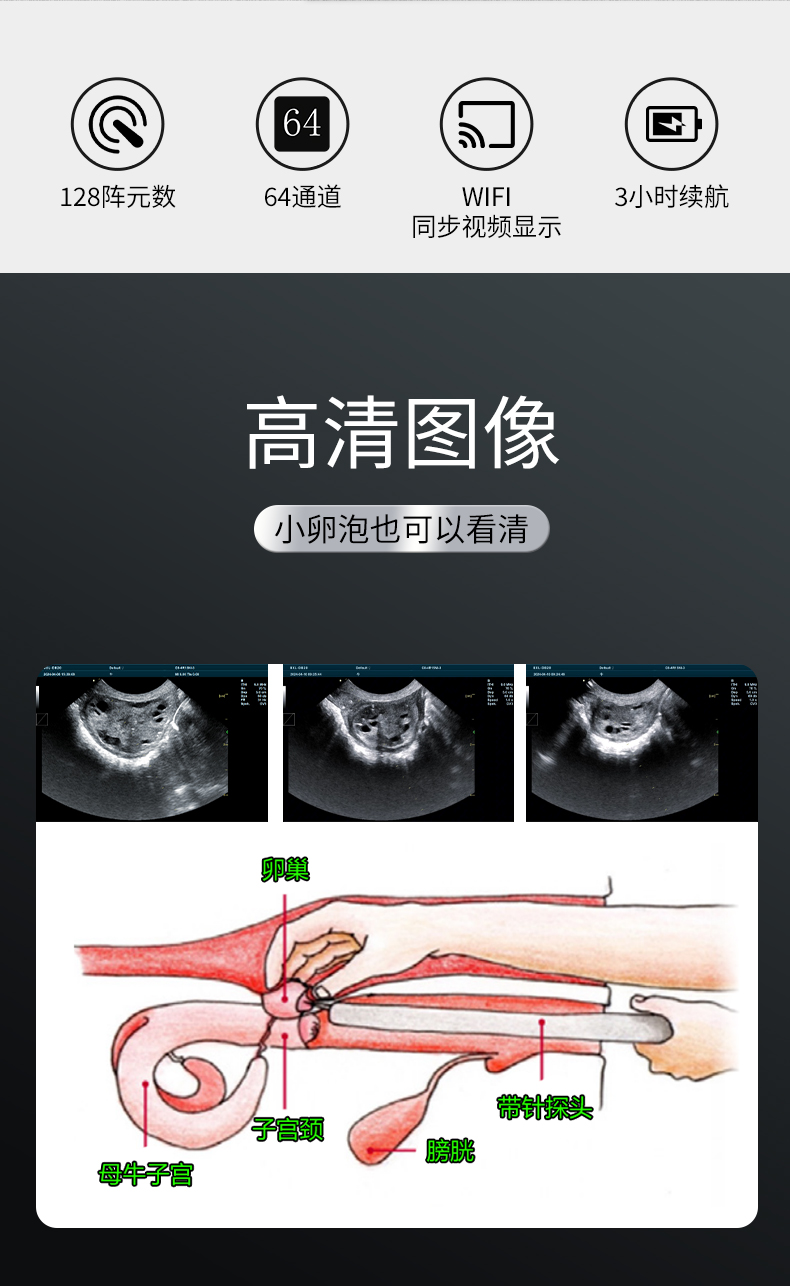 牛馬采卵B超探頭規格